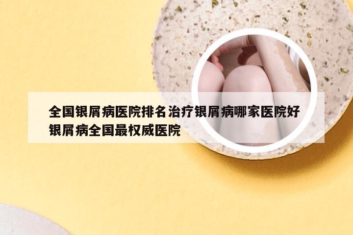 全国银屑病医院排名治疗银屑病哪家医院好 银屑病全国最权威医院