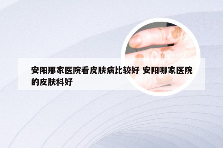 安阳那家医院看皮肤病比较好 安阳哪家医院的皮肤科好