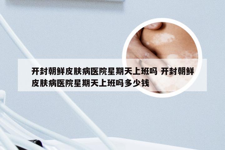 开封朝鲜皮肤病医院星期天上班吗 开封朝鲜皮肤病医院星期天上班吗多少钱