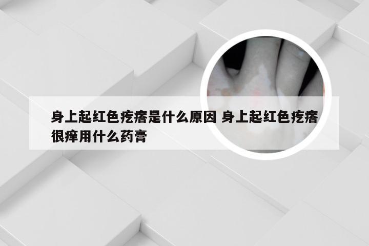 身上起红色疙瘩是什么原因 身上起红色疙瘩很痒用什么药膏
