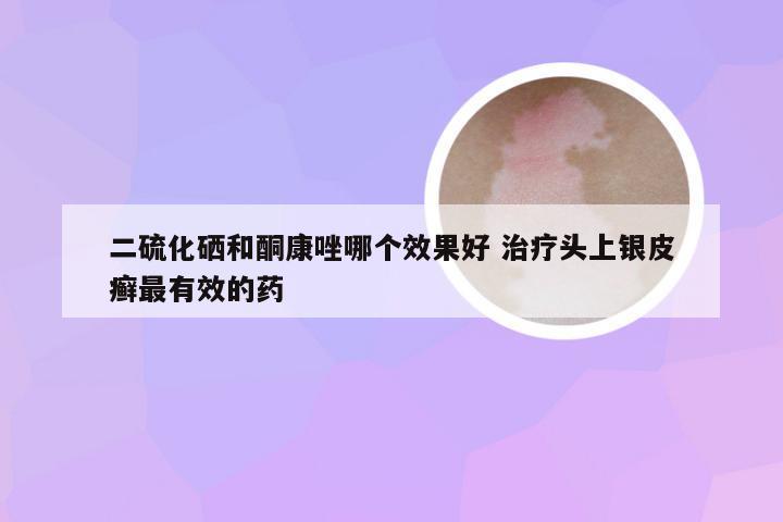 二硫化硒和酮康唑哪个效果好 治疗头上银皮癣最有效的药
