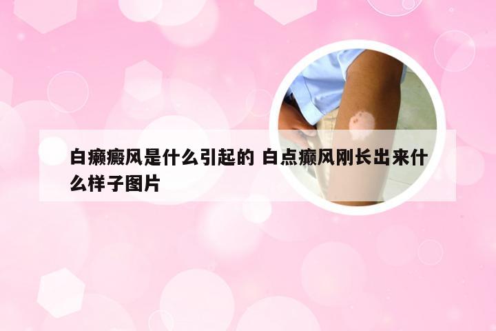 白癞癜风是什么引起的 白点癫风刚长出来什么样子图片