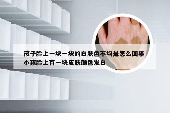 孩子脸上一块一块的白肤色不均是怎么回事 小孩脸上有一块皮肤颜色发白