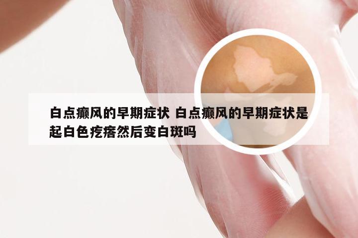 白点癫风的早期症状 白点癫风的早期症状是起白色疙瘩然后变白斑吗