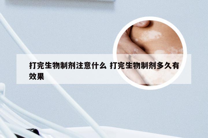 打完生物制剂注意什么 打完生物制剂多久有效果
