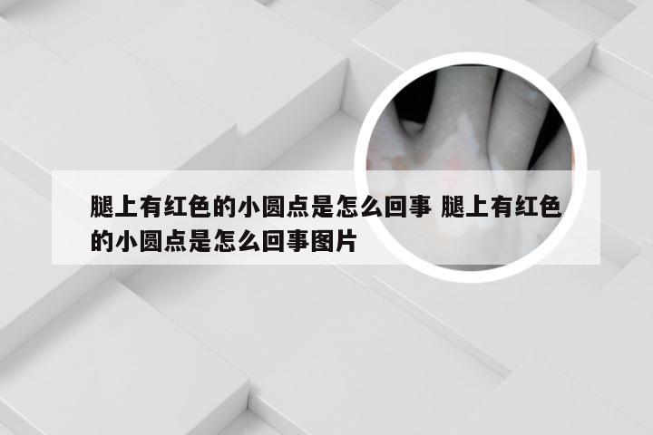 腿上有红色的小圆点是怎么回事 腿上有红色的小圆点是怎么回事图片