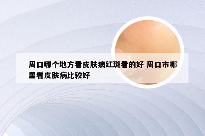 周口哪个地方看皮肤病红斑看的好 周口市哪里看皮肤病比较好