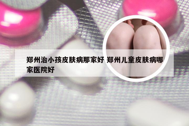 郑州治小孩皮肤病那家好 郑州儿童皮肤病哪家医院好
