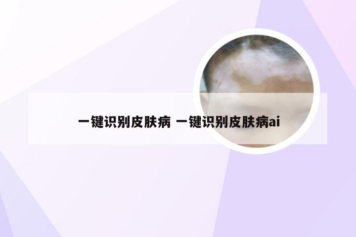 一键识别皮肤病 一键识别皮肤病ai