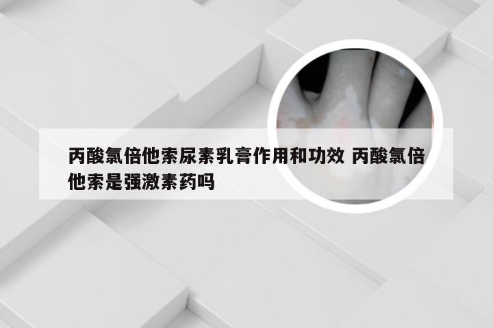 丙酸氯倍他索尿素乳膏作用和功效 丙酸氯倍他索是强激素药吗
