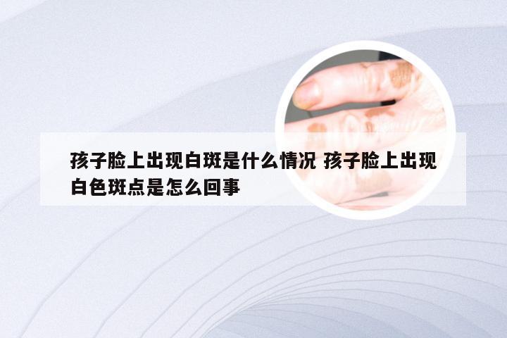 孩子脸上出现白斑是什么情况 孩子脸上出现白色斑点是怎么回事