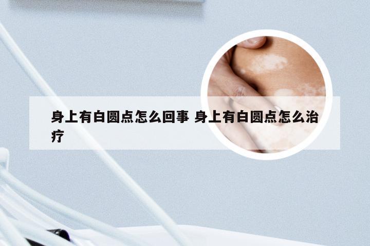身上有白圆点怎么回事 身上有白圆点怎么治疗