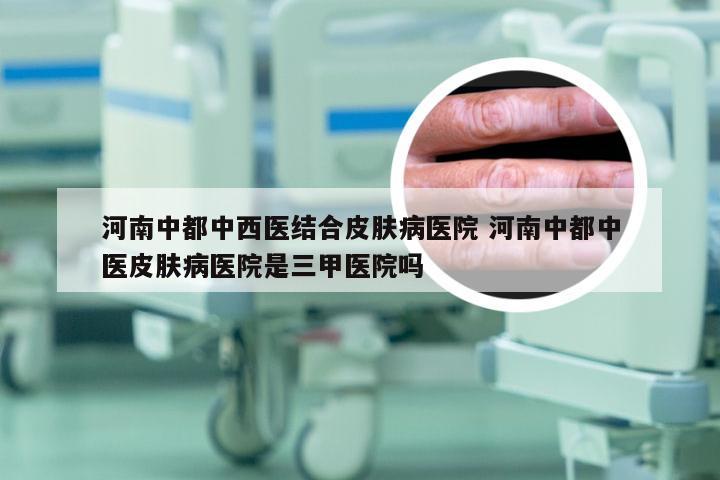 河南中都中西医结合皮肤病医院 河南中都中医皮肤病医院是三甲医院吗