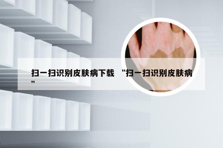 扫一扫识别皮肤病下载 “扫一扫识别皮肤病”