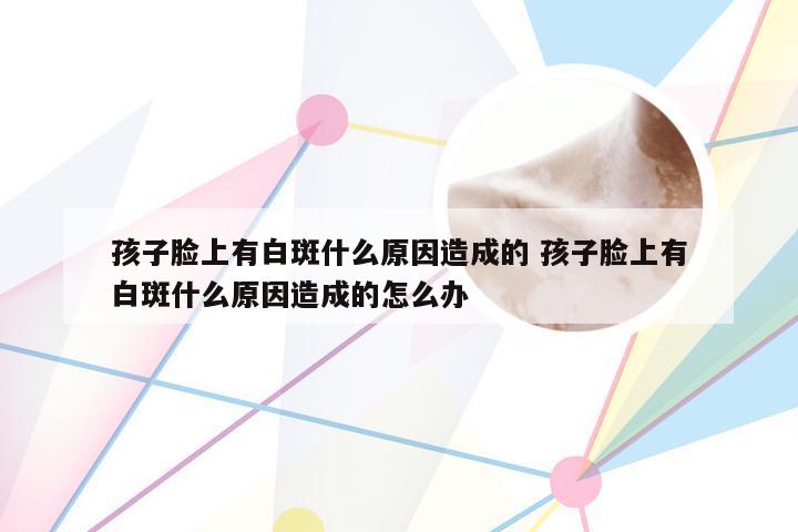 孩子脸上有白斑什么原因造成的 孩子脸上有白斑什么原因造成的怎么办