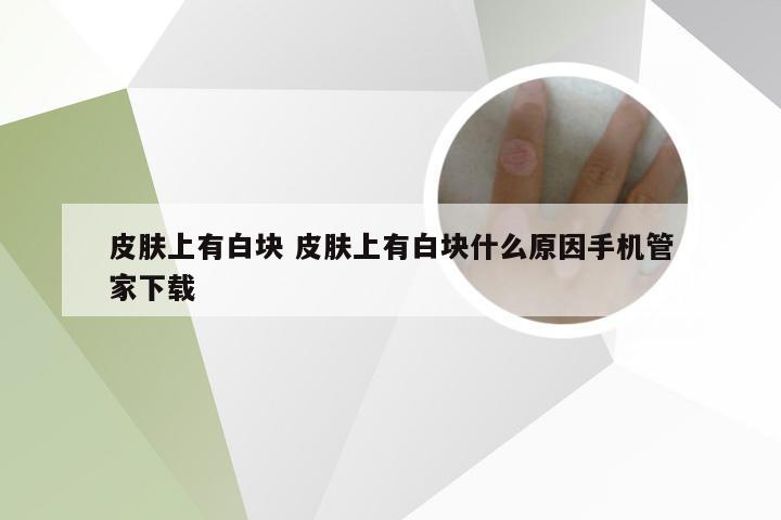 皮肤上有白块 皮肤上有白块什么原因手机管家下载