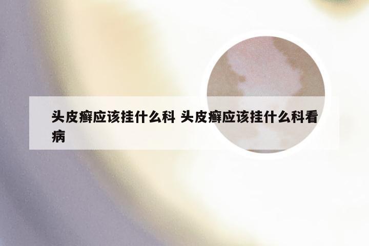 头皮癣应该挂什么科 头皮癣应该挂什么科看病