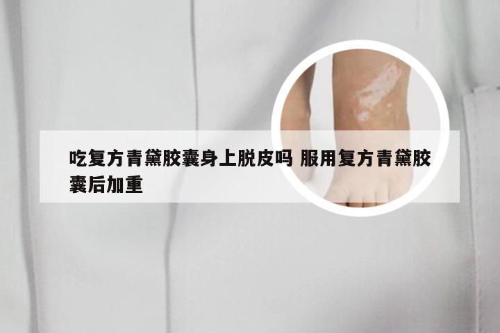 吃复方青黛胶囊身上脱皮吗 服用复方青黛胶囊后加重
