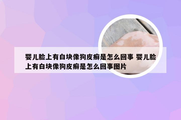 婴儿脸上有白块像狗皮癣是怎么回事 婴儿脸上有白块像狗皮癣是怎么回事图片