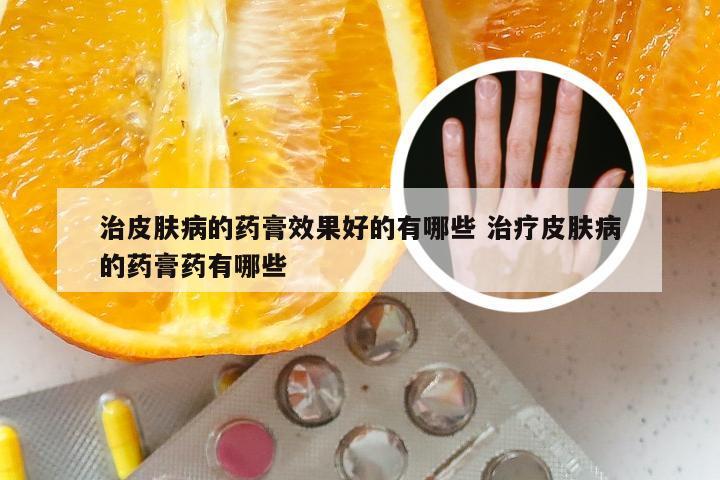 治皮肤病的药膏效果好的有哪些 治疗皮肤病的药膏药有哪些