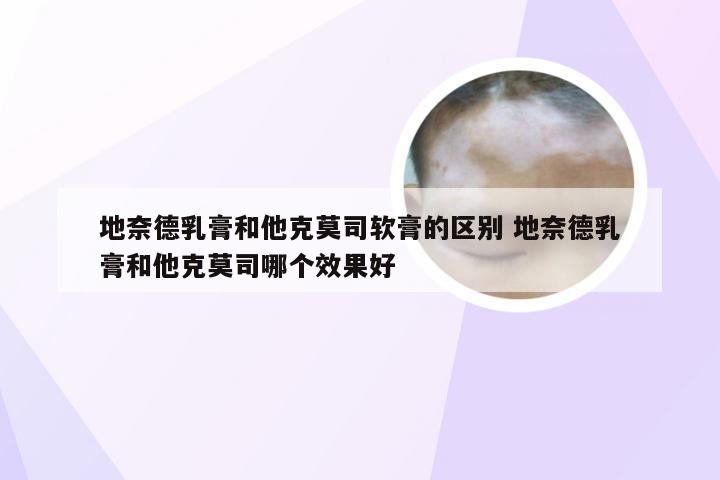 地奈德乳膏和他克莫司软膏的区别 地奈德乳膏和他克莫司哪个效果好