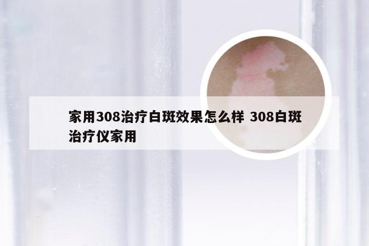 家用308治疗白斑效果怎么样 308白斑治疗仪家用