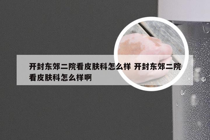 开封东郊二院看皮肤科怎么样 开封东郊二院看皮肤科怎么样啊