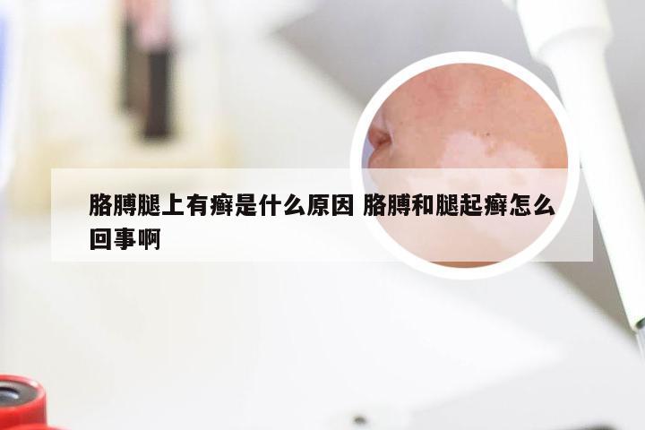 胳膊腿上有癣是什么原因 胳膊和腿起癣怎么回事啊