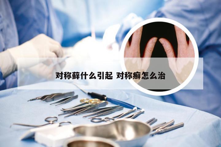 对称藓什么引起 对称癣怎么治