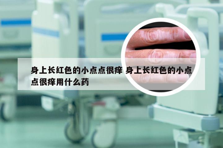 身上长红色的小点点很痒 身上长红色的小点点很痒用什么药
