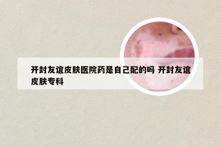 开封友谊皮肤医院药是自己配的吗 开封友谊皮肤专科