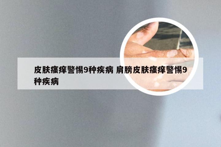 皮肤瘙痒警惕9种疾病 肩膀皮肤瘙痒警惕9种疾病