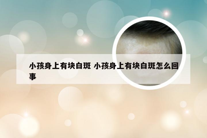 小孩身上有块白斑 小孩身上有块白斑怎么回事