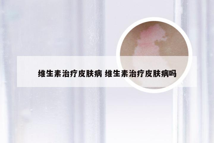 维生素治疗皮肤病 维生素治疗皮肤病吗