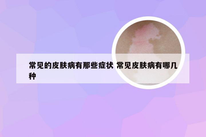 常见的皮肤病有那些症状 常见皮肤病有哪几种