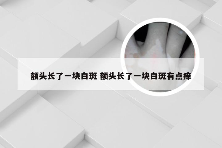 额头长了一块白斑 额头长了一块白斑有点痒