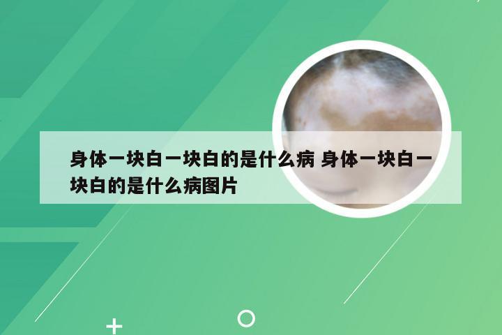 身体一块白一块白的是什么病 身体一块白一块白的是什么病图片