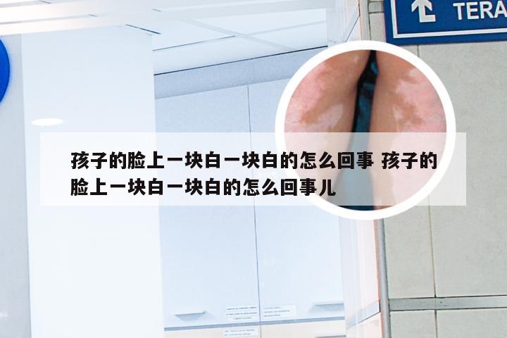 孩子的脸上一块白一块白的怎么回事 孩子的脸上一块白一块白的怎么回事儿