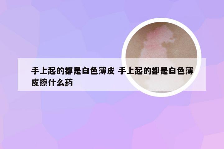 手上起的都是白色薄皮 手上起的都是白色薄皮擦什么药