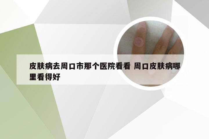 皮肤病去周口市那个医院看看 周口皮肤病哪里看得好