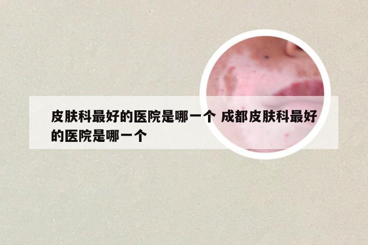 皮肤科最好的医院是哪一个 成都皮肤科最好的医院是哪一个