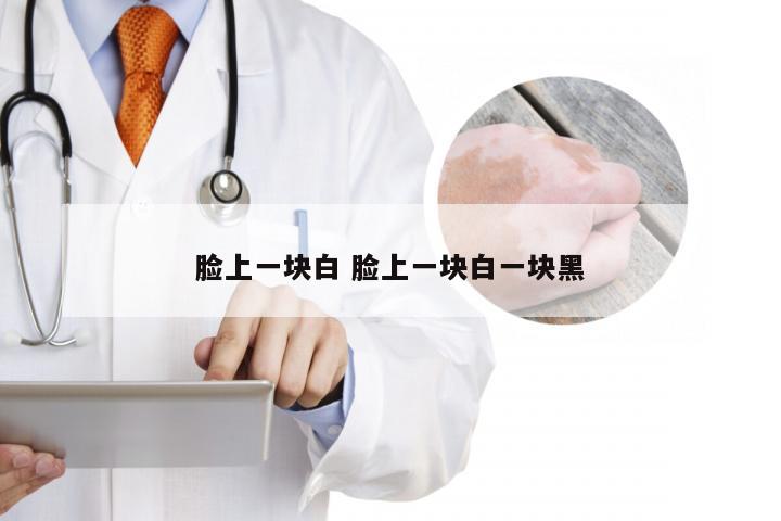 脸上一块白 脸上一块白一块黑