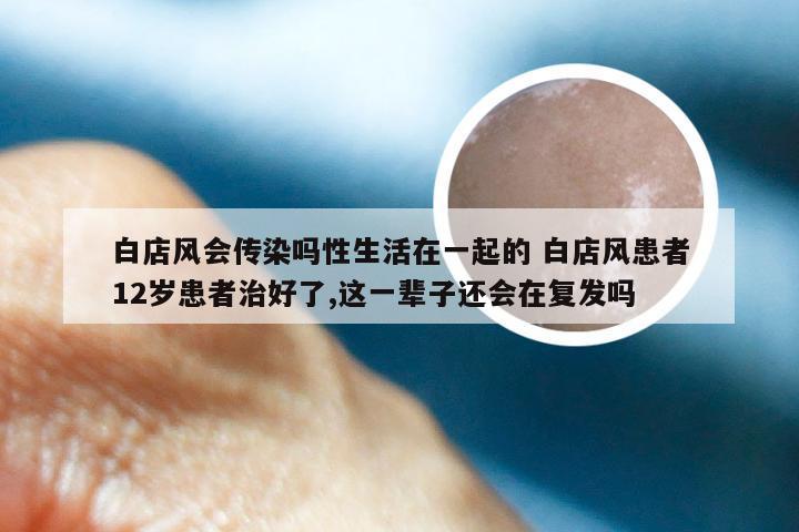 白店风会传染吗性生活在一起的 白店风患者12岁患者治好了,这一辈子还会在复发吗