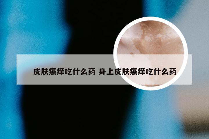 皮肤瘙痒吃什么药 身上皮肤瘙痒吃什么药