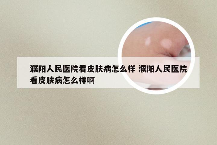 濮阳人民医院看皮肤病怎么样 濮阳人民医院看皮肤病怎么样啊
