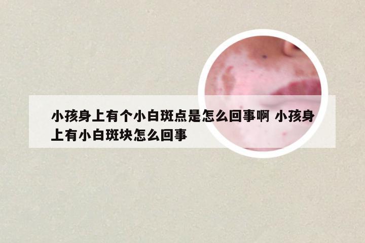 小孩身上有个小白斑点是怎么回事啊 小孩身上有小白斑块怎么回事