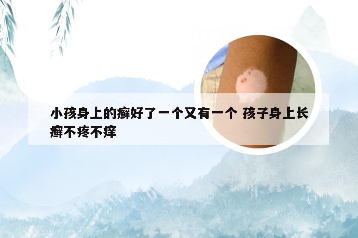 小孩身上的癣好了一个又有一个 孩子身上长癣不疼不痒