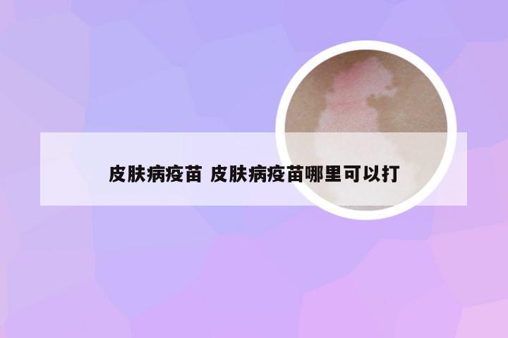 皮肤病疫苗 皮肤病疫苗哪里可以打