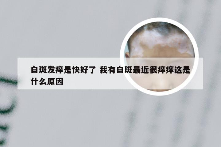 白斑发痒是快好了 我有白斑最近很痒痒这是什么原因