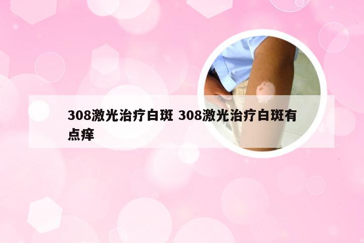 308激光治疗白斑 308激光治疗白斑有点痒